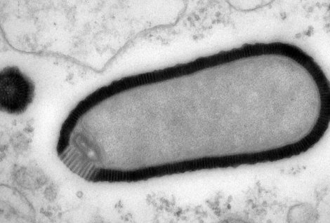 You can tell it's an old-timey virus from the push-broom mustache. 